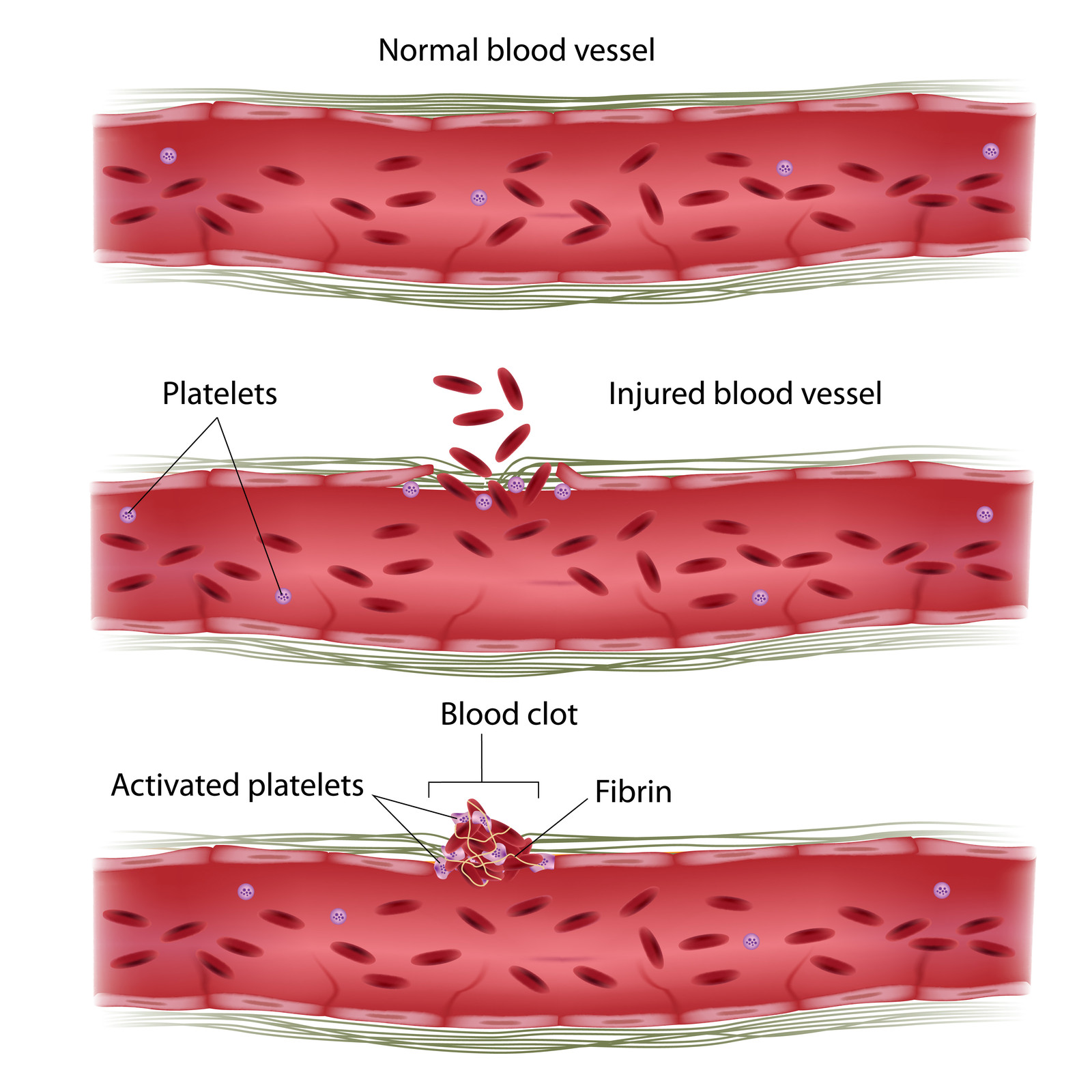 Blood Clotting